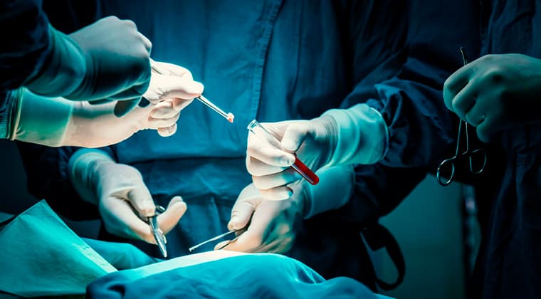 Biopsias quirúrgicas (de piel, ganglios, órganos abdominales)