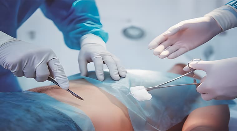 Cirugía de emergencia abdominal