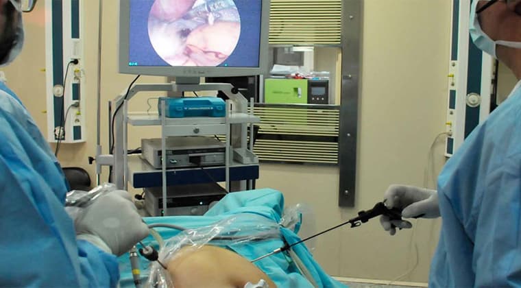 Cirugía laparoscópica diagnóstica (Mínima invasión)