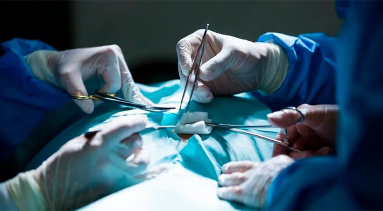 Manejo de complicaciones quirúrgicas